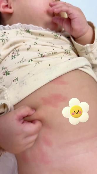 以油养肤!崔玉涛的一页果然名不虚传,真的后悔没有早点给闺女安排!#一页润肤油#一页身体乳#崔玉涛 #先油后乳