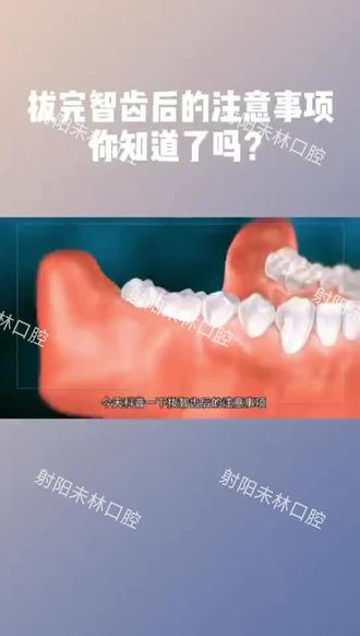 抬完智齿注意事项#射阳未林口腔#口腔医生 #口腔医学 #口腔科普