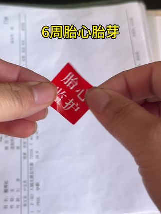 这种又大又硬的#收纳册 赶紧别买了,携带真的不方便! #二胎 我果断换成了这种小巧精致的,布面的材质还能折叠,b超大单子、雪检小单子都能有序收纳,小小的一本带去产检很方便#产检记录#孕期好物分享