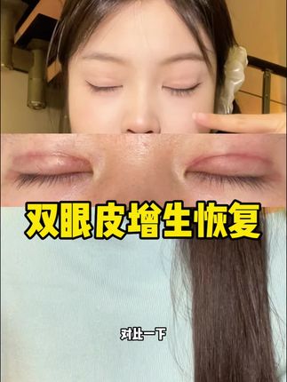真的巨巨巨巨好用#芭克去疤膏 #芭克硅凝胶 #芭克