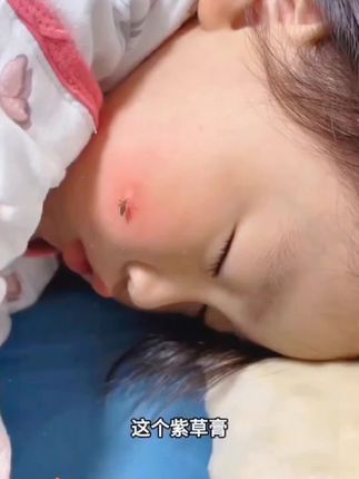 怕蚊子的宝宝赶紧囤这款紫草膏,小巧方便#紫草膏 #蚊虫叮咬 #防蚊必备 #宝宝防蚊神器