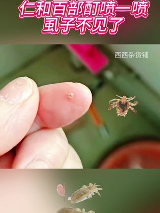 仁和复方百部酊喷剂虱子虱卵一扫光男女阴用#百部酊喷剂 #虱子 #消除虱子卵的小妙招 #身上长虱子怎么消除 #虱子克星