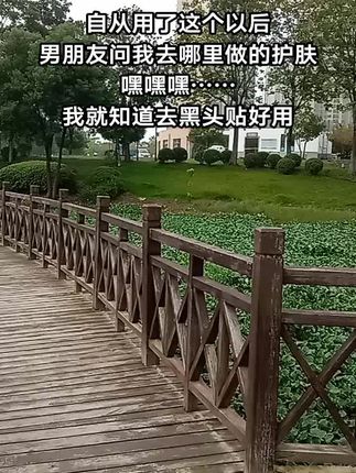 青春期孩子很容易长黑头,好难看,还得用这种黑头贴处理,才不怕伤毛孔变粗大。#宝妈分享 #袋鼠妈妈 #青少年 #去黑头贴