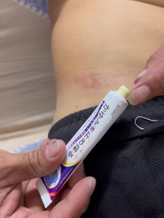 #日常保养 #皮肤瘙痒湿痒的止痒膏 #日常分享