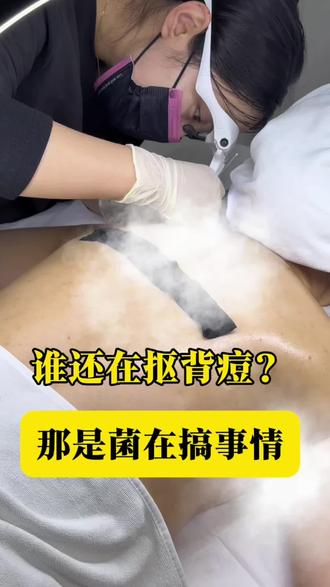 前胸后背痘➕鸡皮肤看过来
夏天从满背痘到吊带裙 你可以来找我试试
#无痛针清 #临沂皮肤管理 #前胸后背痘 #鸡皮肤 #睿路细胞夹