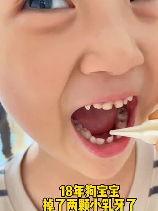 孩子掉下来的乳牙你们都是怎么处理的?#乳牙#乳牙收纳盒 #成长#换牙