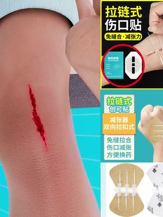 绷带减张贴免缝针胶带伤口缝合减张器拉链式创可贴无痛缝合贴#拉链式创可贴 #无痛缝合贴 #爆款热卖中 #减张贴