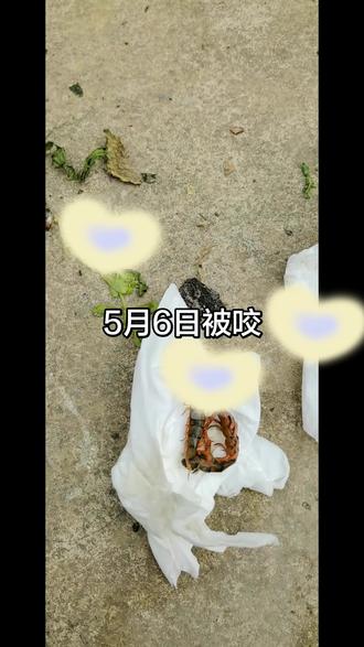 蜈蚣咬伤后,一定在最短时间内用肥皂水清洗,没有肥皂水用清水也可以的,然后第一时间去医治。个人经历希望对大家有帮助,当时心现很慌,因为被蜈蚣咬了很剌痛那种痛可不一般,因为它是毒物(亲身体会),我马上冷静下来叫老婆找来肥皂用清水冲洗。第一时间用上***后面我就没管它了。#你可以不用但是不能没有
