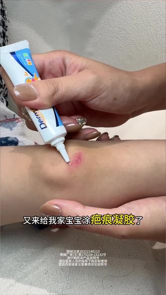 小孩玩耍难免会有些小伤疤,咱们当妈的可以提前备上,防止留疤难看。但是大家一定要认准正品!别踩坑了#硅酮#疤 #倍舒痕儿童款 #摔倒