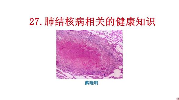 肺结核病相关的健康知识