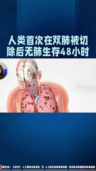 从濒死到重生:无肺生存48小时,他打赢生命硬仗