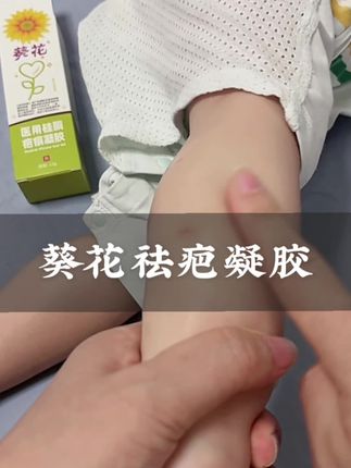 #疤痕凝胶 选贵的不如选对的,认准医用硅酮才是关键,#葵花 家里有娃的可以提前备上#母婴好物 #宝宝护理 #宝宝磕碰