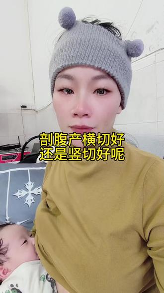 剖腹产横切好,还是竖切好呢#剖腹产#宝妈 #骗你生女儿