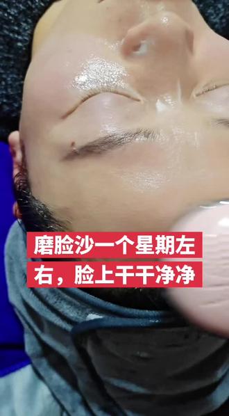 去黑点点黄片片,无效果退米哦#皮肤问题 #去黄提亮 #美白淡斑提亮肤色