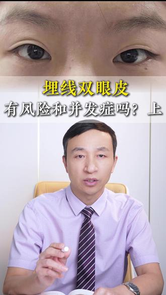 埋线双眼皮到底有风险吗?在这里给你好好分析分析~(上)#双眼皮#蒜皮#医学科普#埋线双眼皮#秦瑞雨