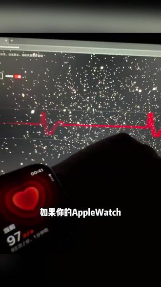 科技不再是高高在上,而是服务于每一个人#applewatch#情绪检测#心情共享#feelflow
