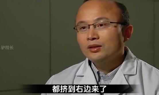 别太离谱、7个月大的男婴怀孕,生下了自己的妹妹..!#离谱 #震惊 #罕见病 #寄生胎 #万万想不到