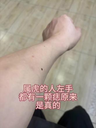 #虎虎生威冠福气 #属虎 #左手长痣 2026属虎左臂有一颗痣,我信了