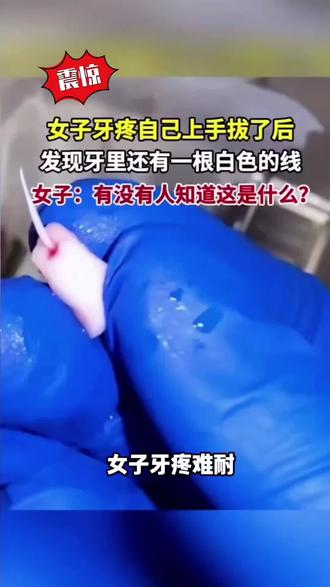 豆包还是太权威,#人类对豆包的开发不足百分之一#豆包ai #科普的重要性 #爱护自己的牙 #豆包知道