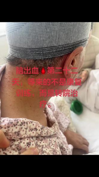 过敏第六天越来越严重,医生停药建议转上级医院治疗,我们一早上忙着办出院收拾东西,中午把孩子安置给亲人照顾,顾不上吃午饭,叫救护车赶紧转院治疗,结果忙活一天,医生说没多大个事,回家洗洗澡就好了,彻底体会了人在无语的时候会想笑😂