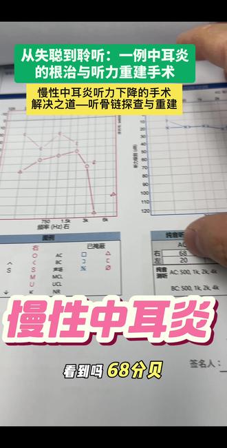 慢性中耳炎听力下降的手术解决之道 从失聪到聆听:一例骨疡型中耳炎的根治与听力重建手术 慢性中耳炎听力下降的手术解决之道——听骨链探查与重建#医者精神以爱为光#抖出健康知识宝藏#医疗健康创作训练营#医务人员的日常工作#慢性中耳炎