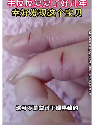 黄皮肤艾草生姜膏!#好物分享#抖音小助手dou上热门