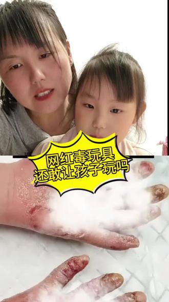 #安全教育 #亲子教育#儿童安全 #网红玩具 #家长必读 家长收藏孩子必须了解的儿童安全隐患