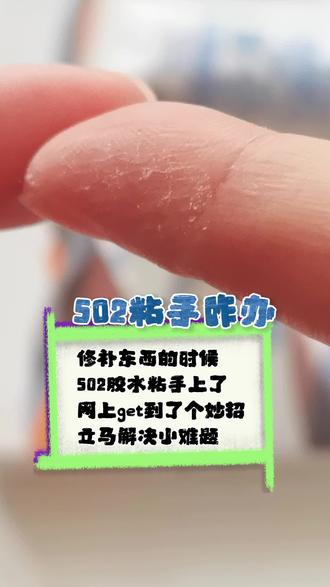 502粘手前晚别硬撕!3步轻松搓掉,亲测有效#生活小妙招 #记录真实生活 #日常分享 #生活边角料vlog