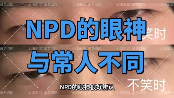 NPD的眼神很好辨别#NPD #npd #npd的眼神 #NPD识别 #npd特点