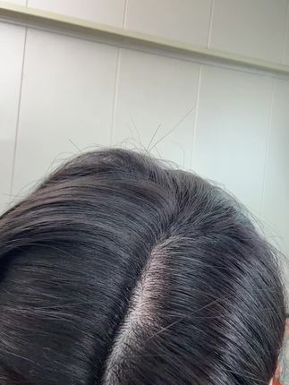 #增加头顶发量 #美丽头发我做主