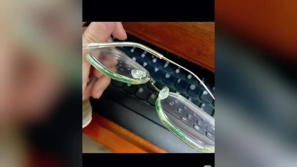 镜架产生铜绿的原因及怎样养护