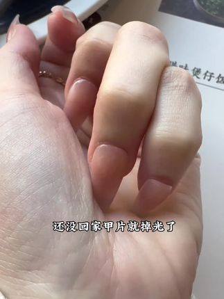 不要再踩雷了‼️谁能看得出这是贴的穿戴甲🥹❓❗️ 保姆级教程简单易懂,新手小白快跟上#固态胶教程 #穿戴甲教程 #新手小白必看 #好物推荐🔥 #穿戴甲随意摘戴 (直播间专属)北鲲科技固态胶贴片胶防水牢固大容量防油贴钻粘花@巨量千川