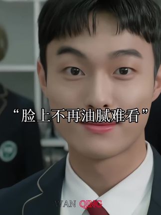 好兄弟,夏天到了,你记住梧高凤必至,花香蝶自来!争取一段时间后,让身边的朋友们都要对你刮目相看!祝兄弟们颜值早日逆袭成功!#自律 #烟酰胺#变帅真的很简单 #改变自己