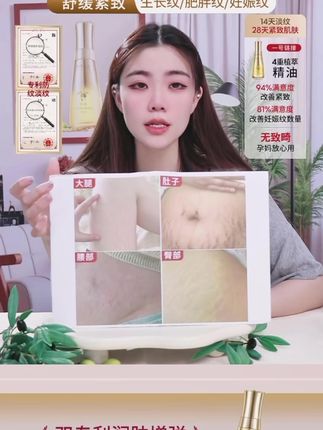 【准孕妇妊娠油】植物主义橄榄油预防纹路滋润增弹植物主义妊娠油#植物主义#孕妇橄榄油 #橄榄油推荐 #孕妇妊娠油