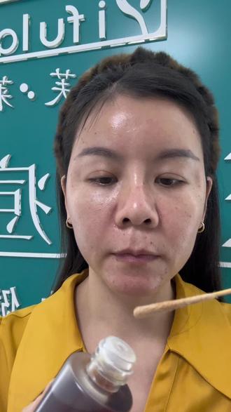 祛ban第二天打卡 排色液涂起来#祛斑的真实视频 #上热门 #记录真实生活