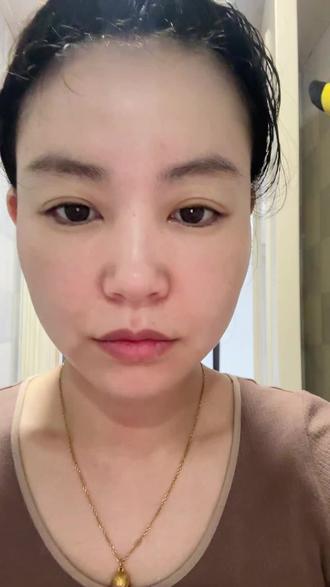 打卡 #凌博士次抛 第75天
#皱纹 #晚间护肤 #玻尿酸 #全分子玻尿酸