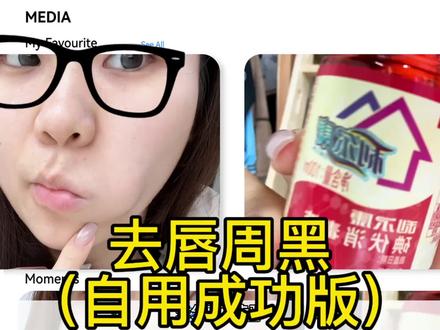 去唇周黑(自用成功分享版)
#唇周黑#唇周暗沉#嘴角暗沉#嘴角黑