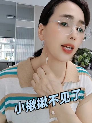 脖子小揪揪#种草#亲测分享#去尤膏