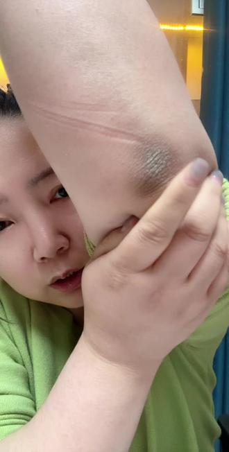 生活习惯造成的皴刺硬洗不干净的胳膊肘点开看#女生必备 #按摩膏 #肘膝霜#冬季手干燥粗糙怎么护理#日常护理