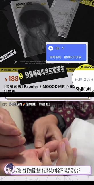 签吧彼得,没日没夜@Rapeter吴嘉轩
#rapeter #吴嘉轩 #IMGOOD别担心我 #实体专辑 #腱鞘炎