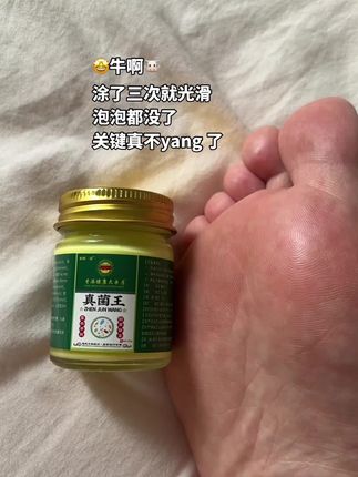 脚趾缝都舒坦了#好物推荐🔥 #真菌王