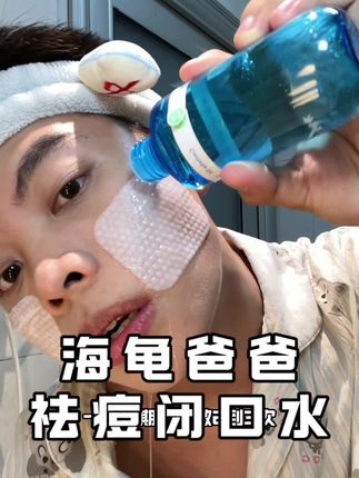 油痘肌一定要去试一下!#祛痘 #油痘肌 #闭口水 #亲测分享