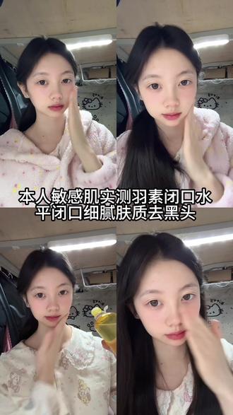 一期真实测评#羽素闭口水#测评#护肤