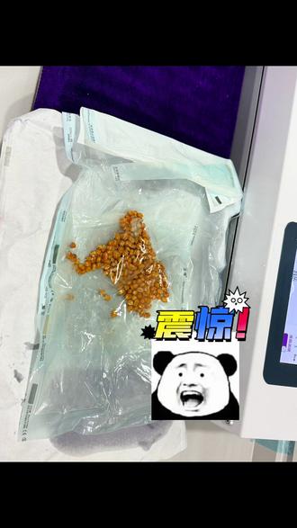 消毒锅子蹦爆米花#日常分享 #牙医的浪漫时光 #实拍