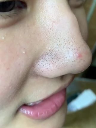 不要再用手摸鼻子了!Tondi茶萃去黑头面膜,吸附毛孔油脂脏东西,摆脱草莓鼻 #去黑头撕拉面膜 #去黑头 #护肤品分享