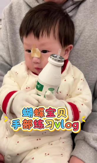 尽量你生病了
但妈妈还是希望你尽可能和正常小孩一样
手套松了掉了不要紧
妈妈可以重新帮你护理
加油⛽⛽⛽
#记录真实生活 #日常vlog #蝴蝶宝贝 #罕见病 #人类幼崽