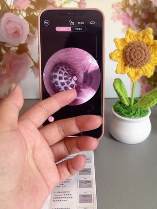 可视掏耳勺了解一下#可视掏耳勺 #可视采耳 #掏耳神器