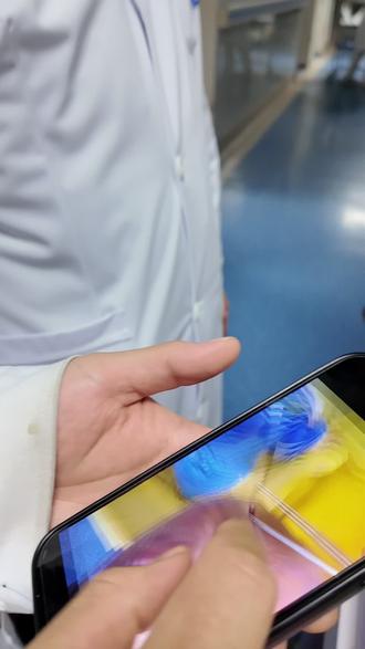 患者脚部烫伤后,又引发感染 #骨科#骨科医生 #糖尿病足 #科普