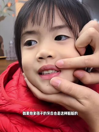 一直给孩子用这个双益奥拉氟牙膏,更好保护孩子牙齿,水果味不辣口,孩子喜欢#儿童牙膏 #奥拉氟牙膏