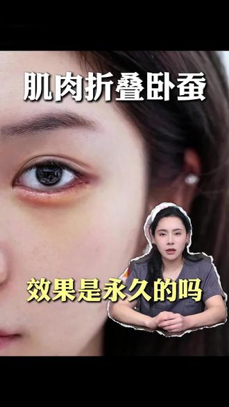 肌肉筋膜折叠卧蚕是永久的吗? #眼袋修复 #自体卧蚕 #肌肉折叠卧蚕 #李坤坤 #眼修复